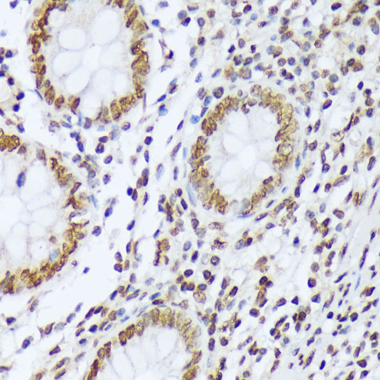 Phospho-c-Abl-Y412 Rabbit Polyclonal Antibody - Image 3