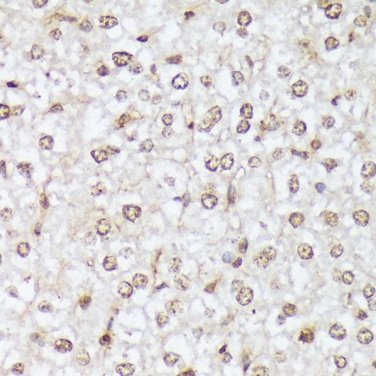 Phospho-c-Abl-Y412 Rabbit Polyclonal Antibody - Image 4