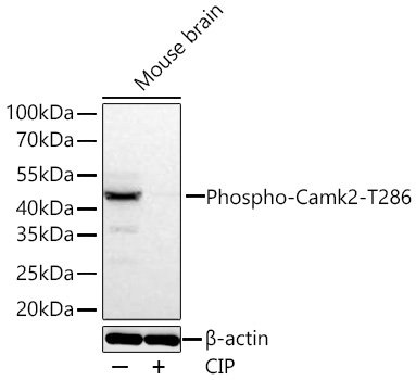 Phospho-Camk2-T286 Rabbit Monoclonal Antibody