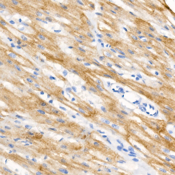 Phospho-Cardiac Troponin I (TNNI3)-S23/S24 Rabbit Monoclonal Antibody