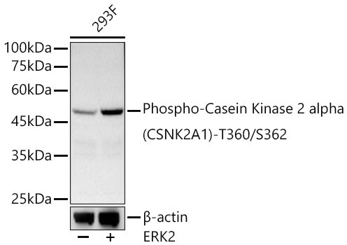 Phospho-Casein Kinase 2 alpha (CSNK2A1)-T360/S362 Rabbit Polyclonal Antibody