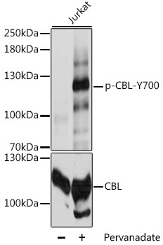 Phospho-CBL-Y700 Rabbit Polyclonal Antibody