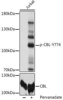 Phospho-CBL-Y774 Rabbit Polyclonal Antibody