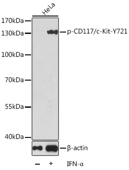Phospho-CD117/c-Kit-Y721 Rabbit Polyclonal Antibody