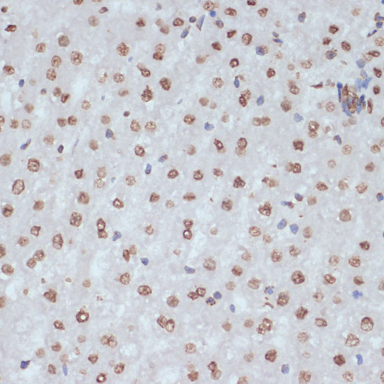 Phospho-CDK1-Y15 Rabbit Polyclonal Antibody - Image 4