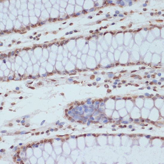 Phospho-CDK1-Y15 Rabbit Polyclonal Antibody - Image 5