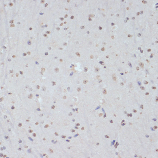 Phospho-CDK1-Y15 Rabbit Polyclonal Antibody - Image 6