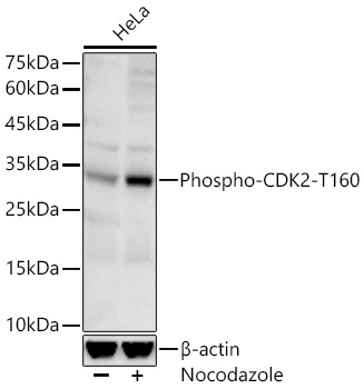 Phospho-CDK2-T160 Rabbit Monoclonal Antibody