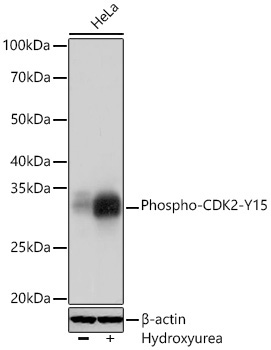Phospho-CDK2-Y15 Rabbit Monoclonal Antibody - Image 2