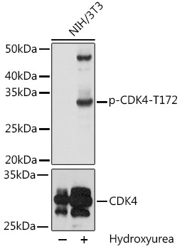 Phospho-CDK4-T172 Rabbit Polyclonal Antibody