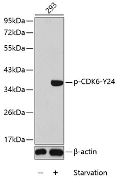 Phospho-CDK6-Y24 Rabbit Polyclonal Antibody