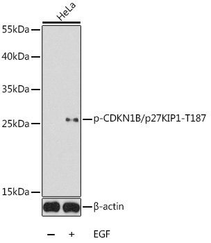 Phospho-CDKN1B/p27KIP1-T187 Rabbit Polyclonal Antibody