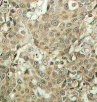 Phospho-CFL1-S3 Rabbit Polyclonal Antibody - Image 2