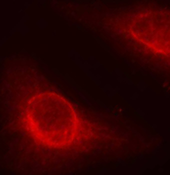 Phospho-CFL1-S3 Rabbit Polyclonal Antibody - Image 3