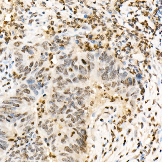 Phospho-CFL1-Y139 Rabbit Polyclonal Antibody