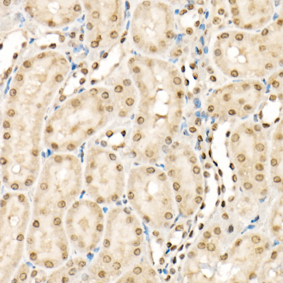 Phospho-CFL1-Y139 Rabbit Polyclonal Antibody - Image 2