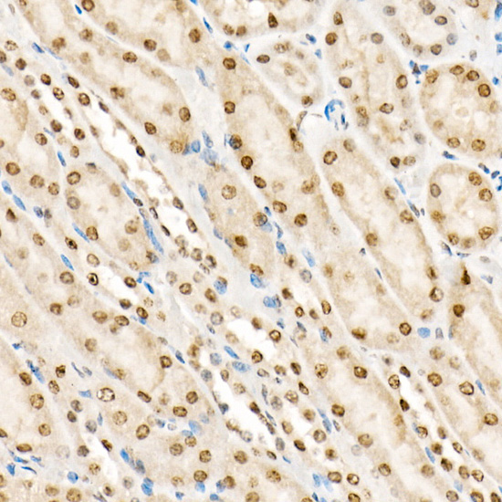 Phospho-CFL1-Y139 Rabbit Polyclonal Antibody - Image 3