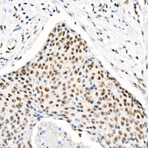 Phospho-Chk2-T68 Rabbit Monoclonal Antibody