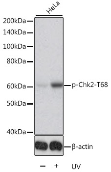 Phospho-Chk2-T68 Rabbit Polyclonal Antibody