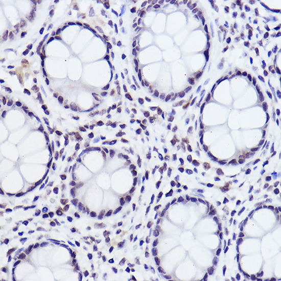 Phospho-c-Jun-S243 Rabbit Polyclonal Antibody