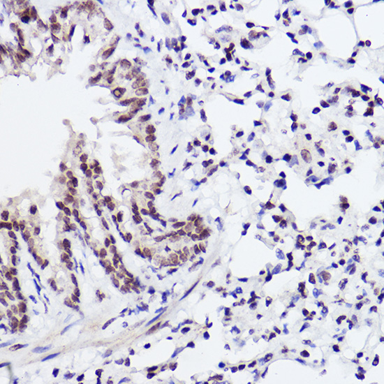 Phospho-c-Jun-S243 Rabbit Polyclonal Antibody - Image 2