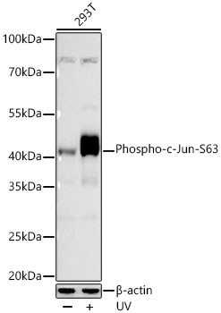 Phospho-c-Jun-S63 Rabbit Monoclonal Antibody
