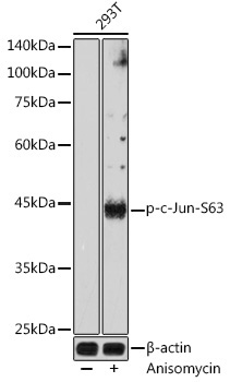 Phospho-c-Jun-S63 Rabbit Polyclonal Antibody