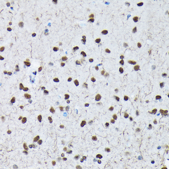 Phospho-c-Jun-S63 Rabbit Polyclonal Antibody - Image 2