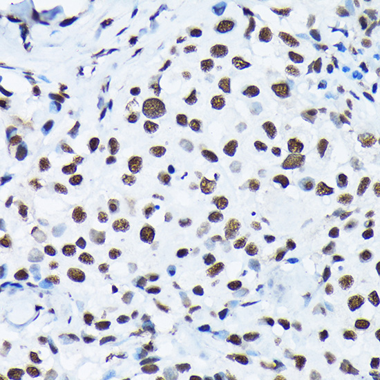 Phospho-c-Jun-S63 Rabbit Polyclonal Antibody - Image 3