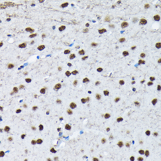 Phospho-c-Jun-S63 Rabbit Polyclonal Antibody - Image 4