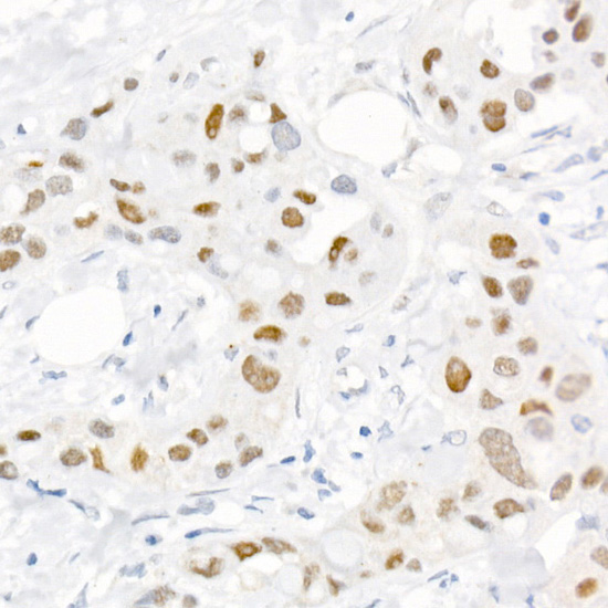 Phospho-c-Jun-S73 Rabbit Polyclonal Antibody - Image 2