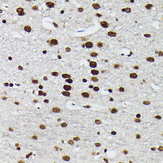 Phospho-c-Jun-S73 Rabbit Polyclonal Antibody - Image 2