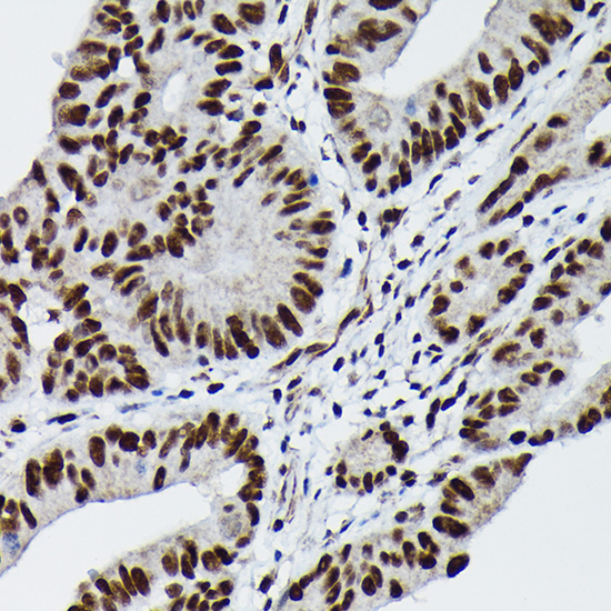 Phospho-c-Jun-S73 Rabbit Polyclonal Antibody - Image 3