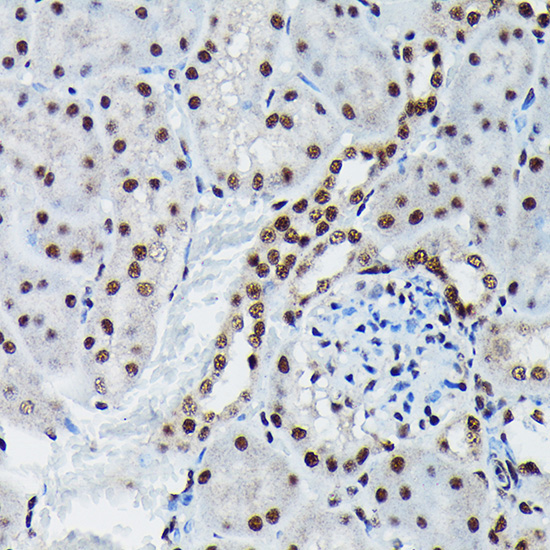 Phospho-c-Jun-S73 Rabbit Polyclonal Antibody - Image 4