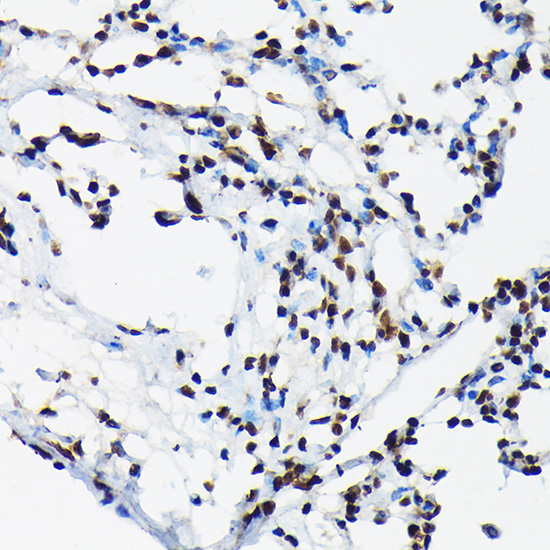 Phospho-c-Jun-T91 Rabbit Polyclonal Antibody - Image 2