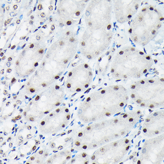 Phospho-c-Jun-T91 Rabbit Polyclonal Antibody - Image 4