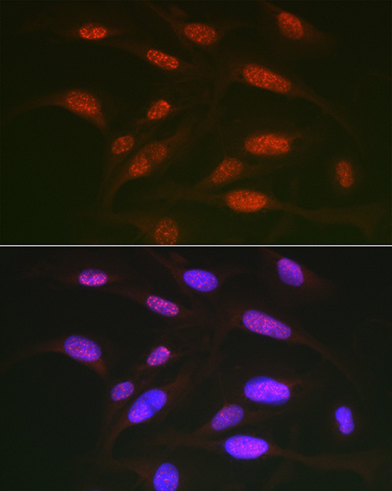Phospho-c-Jun-T91 Rabbit Polyclonal Antibody - Image 5