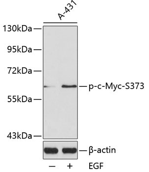 Phospho-c-Myc-S373 Rabbit Polyclonal Antibody