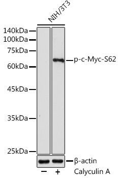 Phospho-c-Myc-S62 Rabbit Polyclonal Antibody