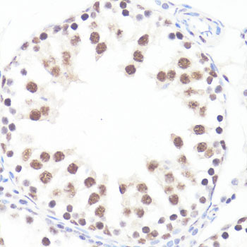 Phospho-c-Myc-S62 Rabbit Polyclonal Antibody - Image 2