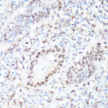 Phospho-c-Myc-S62 Rabbit Polyclonal Antibody - Image 3