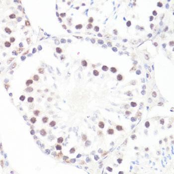 Phospho-c-Myc-S62 Rabbit Polyclonal Antibody - Image 4