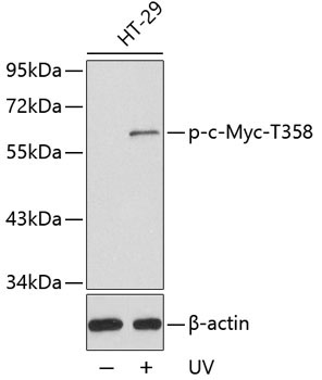 Phospho-c-Myc-T358 Rabbit Polyclonal Antibody