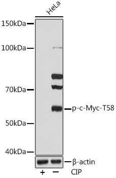 Phospho-c-Myc-T58 Rabbit Monoclonal Antibody