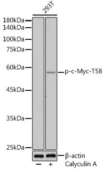 Phospho-c-Myc-T58 Rabbit Polyclonal Antibody