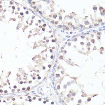 Phospho-c-Myc-T58 Rabbit Polyclonal Antibody - Image 2
