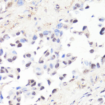 Phospho-c-Myc-T58 Rabbit Polyclonal Antibody - Image 3