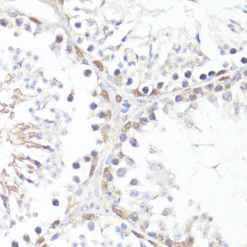 Phospho-c-Myc-T58 Rabbit Polyclonal Antibody - Image 4