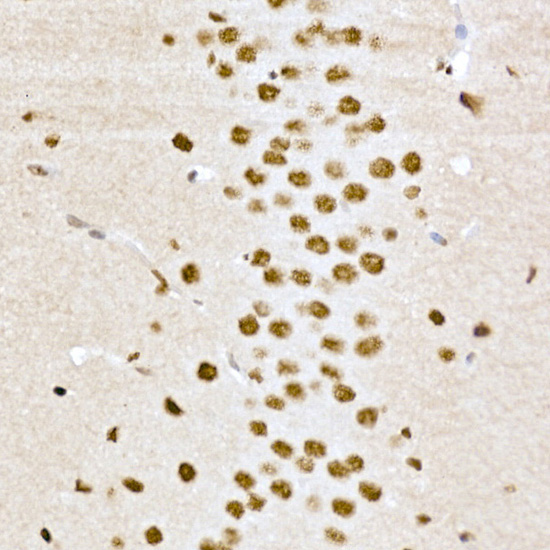 Phospho-CREB1-S133 Rabbit Polyclonal Antibody - Image 3