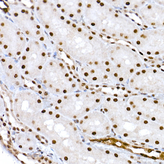 Phospho-CREB1-S133 Rabbit Polyclonal Antibody - Image 4